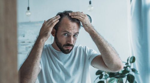 The Psychological Impact of Hair Loss: Navigating Self-Esteem and Confidence