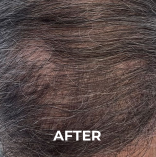 result after treatment