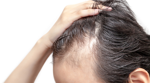 Cutting-Edge Advances in Hair Loss Treatment: Your Most Effective and Cost-Efficient Choice
